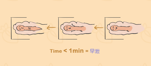 中山治早泄，中山治早泄费用多少，中山治早泄多少钱
